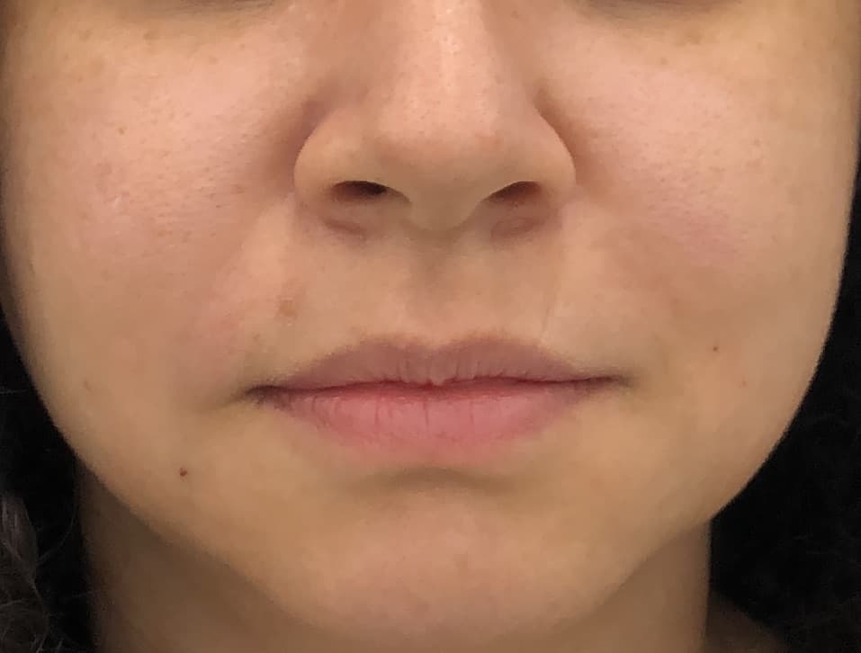 Depois - Bigode Chinês
