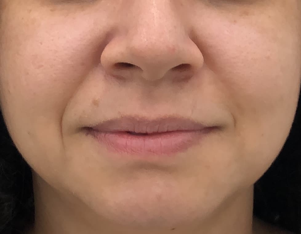 Antes - Bigode Chinês